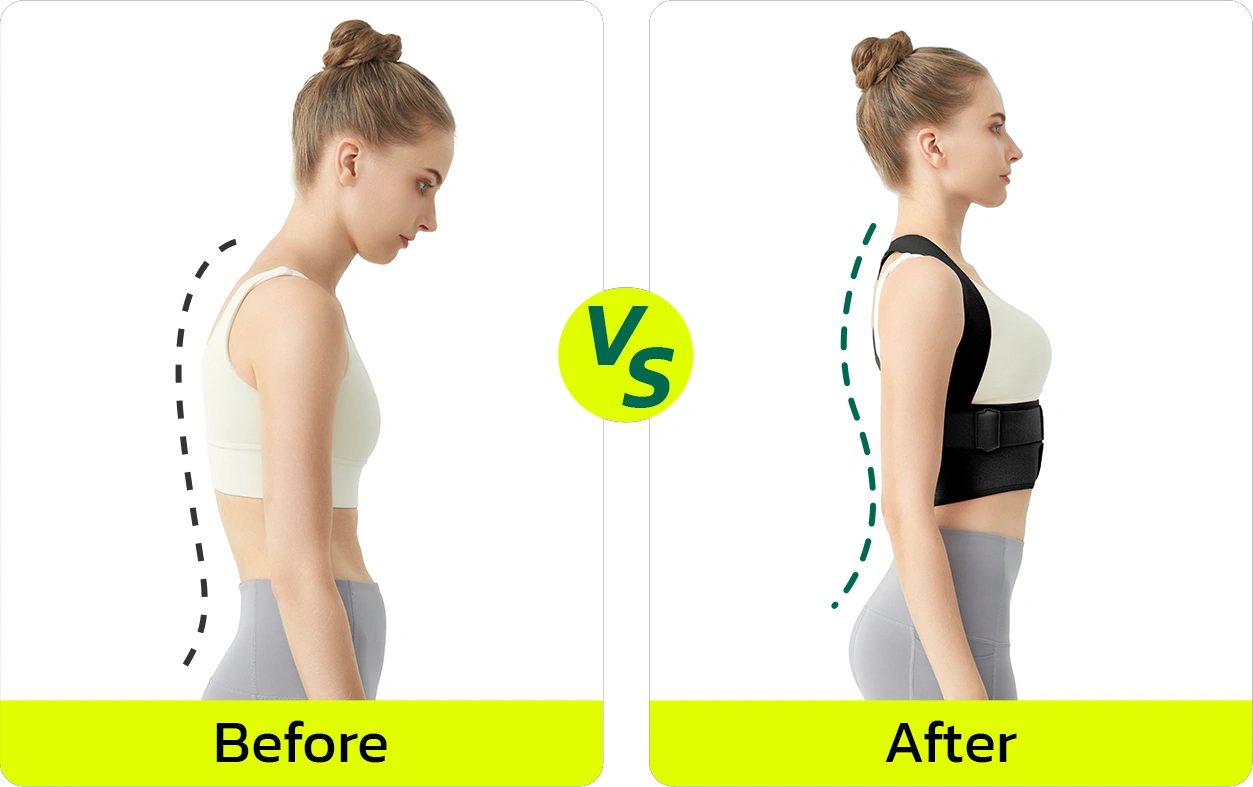 LushLace Posture Corrector